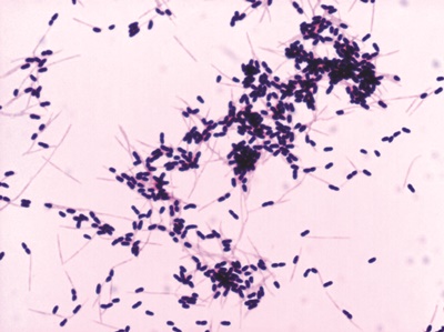 oraCMU가 유해균 Fn균을 억제하는 모습(사진=오라팜)